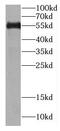 C1q And TNF Related 6 antibody, FNab02066, FineTest, Western Blot image 