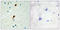 RNA Binding Motif Protein 5 antibody, LS-C118933, Lifespan Biosciences, Immunohistochemistry paraffin image 