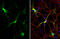 MAP2 antibody, GTX133109, GeneTex, Immunofluorescence image 