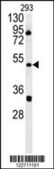 ILK Associated Serine/Threonine Phosphatase antibody, MBS9203281, MyBioSource, Western Blot image 