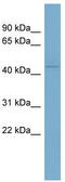 Vitamin D Receptor antibody, TA338378, Origene, Western Blot image 