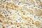 Cyclin Dependent Kinase 6 antibody, 14052-1-AP, Proteintech Group, Immunohistochemistry paraffin image 
