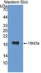 Phospholipid Transfer Protein antibody, abx131267, Abbexa, Western Blot image 