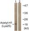 H1 Histone Family Member O Oocyte Specific antibody, P12111, Boster Biological Technology, Western Blot image 