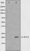 Choriogonadotropin subunit beta antibody, orb224492, Biorbyt, Western Blot image 