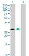 VENT Homeobox antibody, H00027287-B01P, Novus Biologicals, Western Blot image 