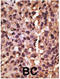 BCL2 Interacting Protein 3 antibody, LS-C98865, Lifespan Biosciences, Immunohistochemistry paraffin image 