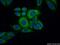 Acyl-CoA Thioesterase 2 antibody, 15633-1-AP, Proteintech Group, Immunofluorescence image 
