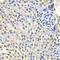 Small Nuclear Ribonucleoprotein D2 Polypeptide antibody, 22-605, ProSci, Immunohistochemistry frozen image 