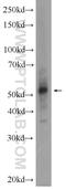 SET Domain Containing 6, Protein Lysine Methyltransferase antibody, 24377-1-AP, Proteintech Group, Western Blot image 