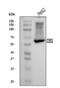 Carboxylesterase 1 antibody, A01741-2, Boster Biological Technology, Western Blot image 
