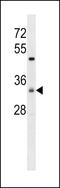 Zinc Finger DHHC-Type Containing 7 antibody, 58-307, ProSci, Western Blot image 