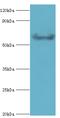 G Protein-Coupled Receptor Kinase 6 antibody, MBS1497037, MyBioSource, Western Blot image 