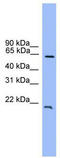Dachshund homolog 1 antibody, TA345490, Origene, Western Blot image 