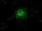 Solute Carrier Family 2 Member 6 antibody, GTX83624, GeneTex, Immunocytochemistry image 