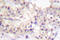 Protein Kinase C Alpha antibody, LS-C176452, Lifespan Biosciences, Immunohistochemistry paraffin image 