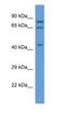 Acyl-CoA Oxidase 3, Pristanoyl antibody, NBP1-74273, Novus Biologicals, Western Blot image 