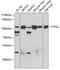 Glycogen Phosphorylase L antibody, GTX33448, GeneTex, Western Blot image 