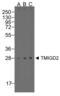 Transmembrane And Immunoglobulin Domain Containing 2 antibody, LS-B16381, Lifespan Biosciences, Western Blot image 