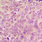 Protein Kinase C Alpha antibody, LS-C368480, Lifespan Biosciences, Immunohistochemistry paraffin image 