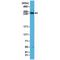 Mechanistic Target Of Rapamycin Kinase antibody, M00003-1, Boster Biological Technology, Western Blot image 