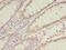 Chaperonin Containing TCP1 Subunit 6B antibody, LS-C378700, Lifespan Biosciences, Immunohistochemistry frozen image 