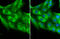 Platelet Derived Growth Factor Receptor Alpha antibody, GTX133619, GeneTex, Immunofluorescence image 