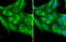 Platelet Derived Growth Factor Receptor Alpha antibody, GTX133619, GeneTex, Immunofluorescence image 