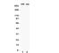 Huntingtin antibody, R31392, NSJ Bioreagents, Western Blot image 