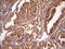 Ankyrin Repeat And SOCS Box Containing 2 antibody, LS-C791487, Lifespan Biosciences, Immunohistochemistry paraffin image 