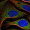 Armadillo Repeat Containing 7 antibody, NBP2-55673, Novus Biologicals, Immunofluorescence image 