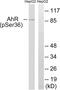 Aryl Hydrocarbon Receptor antibody, abx012465, Abbexa, Western Blot image 