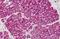 Slit Guidance Ligand 1 antibody, orb86863, Biorbyt, Immunohistochemistry paraffin image 