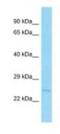 Aph-1 Homolog B, Gamma-Secretase Subunit antibody, NBP1-98414, Novus Biologicals, Western Blot image 