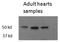 Thyroid Hormone Receptor Beta antibody, orb19614, Biorbyt, Western Blot image 