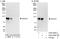 Dachshund homolog 1 antibody, A303-556A, Bethyl Labs, Western Blot image 