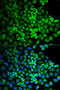Glutamate Ionotropic Receptor AMPA Type Subunit 3 antibody, STJ23860, St John