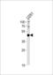 Paired Box 6 antibody, MBS9205035, MyBioSource, Western Blot image 