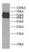 Coiled-Coil Domain Containing 62 antibody, FNab01365, FineTest, Western Blot image 