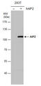 WW Domain Containing E3 Ubiquitin Protein Ligase 2 antibody, GTX115540, GeneTex, Western Blot image 