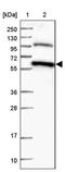 Chromosome 12 Open Reading Frame 4 antibody, PA5-58147, Invitrogen Antibodies, Western Blot image 