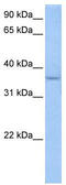 Acid Phosphatase 4 antibody, TA339642, Origene, Western Blot image 