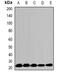 Hypoxanthine Phosphoribosyltransferase 1 antibody, abx141784, Abbexa, Western Blot image 