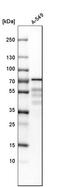 PDZ And LIM Domain 5 antibody, HPA016740, Atlas Antibodies, Western Blot image 