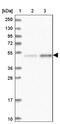 Tetratricopeptide Repeat Domain 4 antibody, NBP1-81906, Novus Biologicals, Western Blot image 
