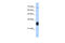 Ring Finger Protein 138 antibody, 27-766, ProSci, Enzyme Linked Immunosorbent Assay image 