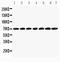SWI/SNF Related, Matrix Associated, Actin Dependent Regulator Of Chromatin, Subfamily B, Member 1 antibody, PA1934, Boster Biological Technology, Western Blot image 