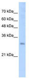 Protein SOX-15 antibody, TA343645, Origene, Western Blot image 