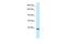 Potassium Voltage-Gated Channel Subfamily Q Member 2 antibody, PA5-68676, Invitrogen Antibodies, Western Blot image 