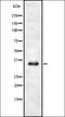 Uracil DNA Glycosylase antibody, orb337004, Biorbyt, Western Blot image 